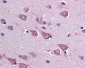 SOCS1 Antibody (C-Terminus)